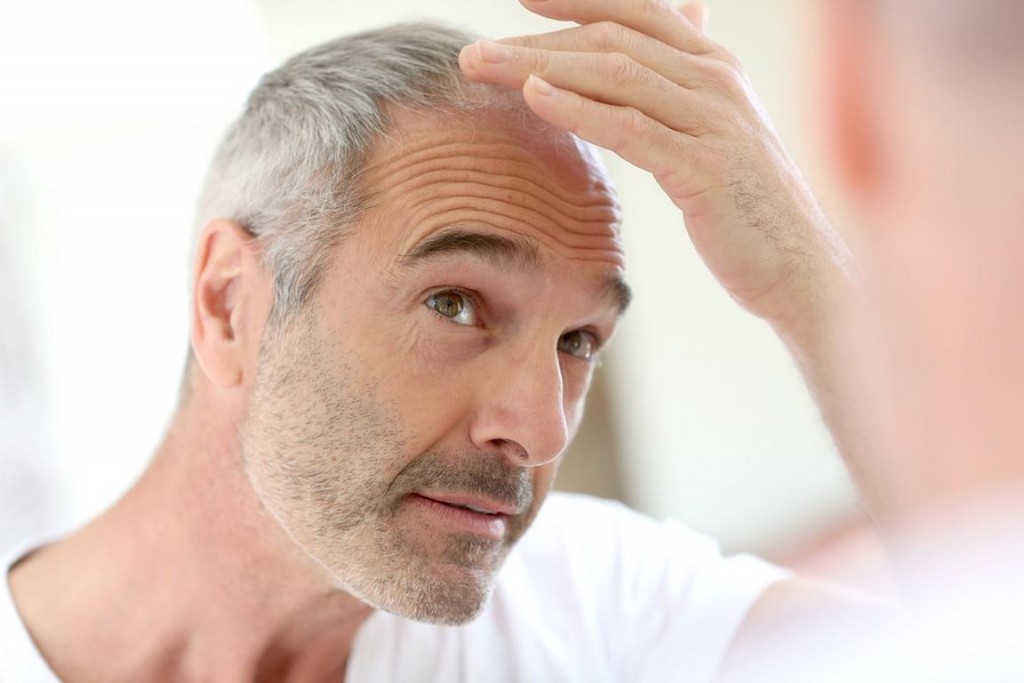 how to regrow hair on shaved head